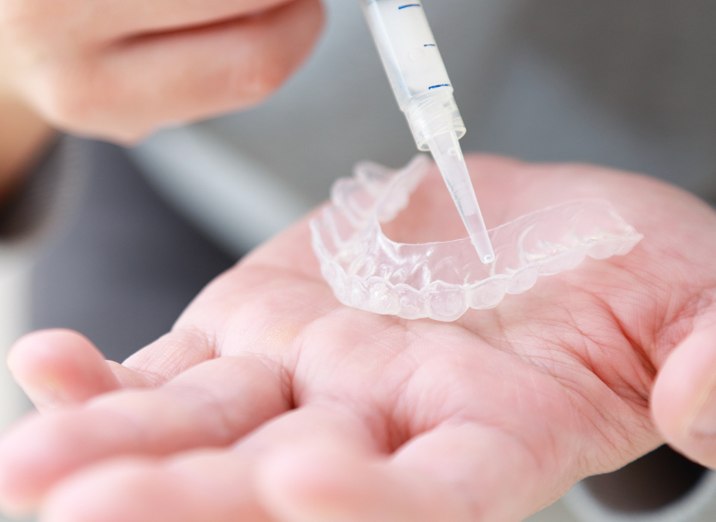 ホームホワイトニング