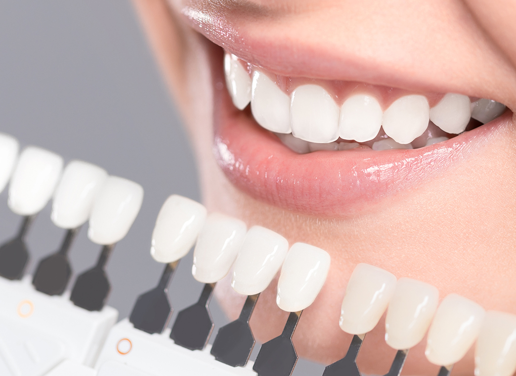 デュアルホワイトニング